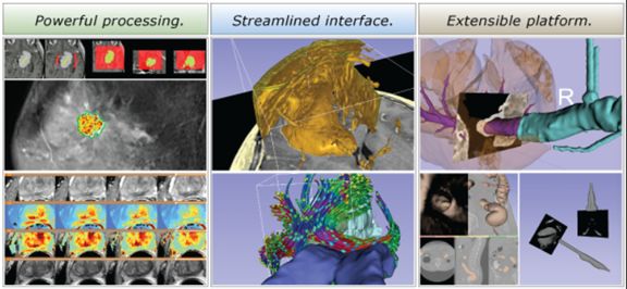 零基础快速上手影像组学与Python（10.30-31精讲班）含3DSlicer莫乎培训XM27