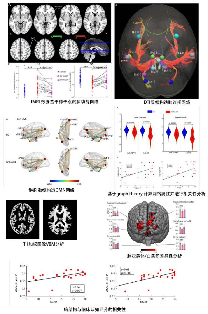 多模态脑影像数据的处理与分析及论文写作培训班 线上玮瑜XW08
