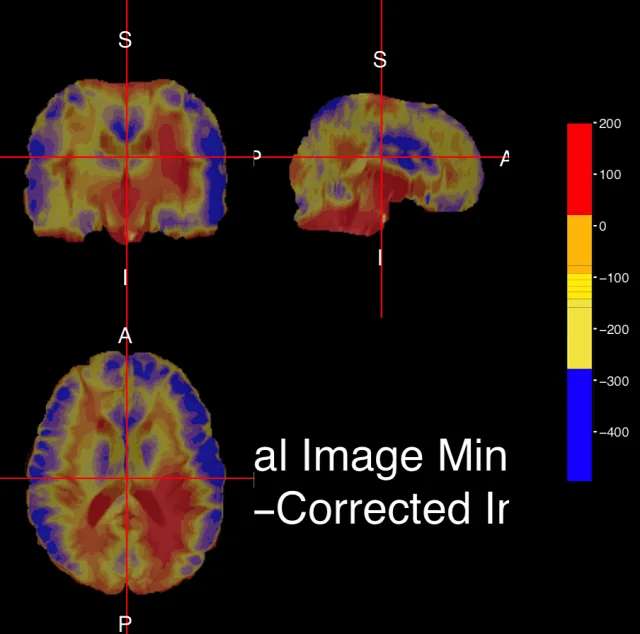 影像组学之神经影像处理与特征提取小白代码YB01