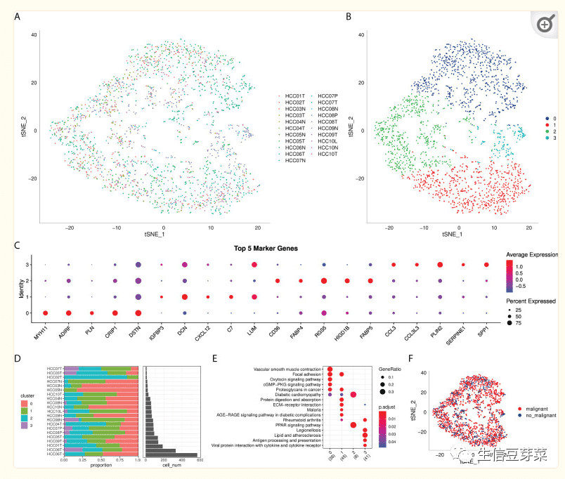 套路七-肿瘤加单细胞加成纤维细胞加免疫治疗生信豆芽菜YU07